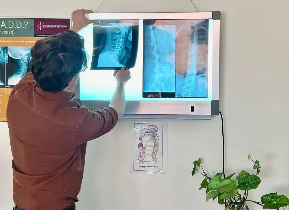 Chiropractor reviewing spinal X-rays on lightbox at Brunswick West Melbourne chiropractic clinic